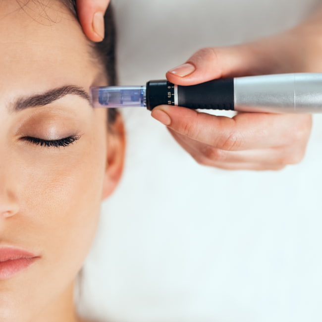 Μεσοθεραπεία Dermapen για ένα λαμπερό και υγιές δέρμα
