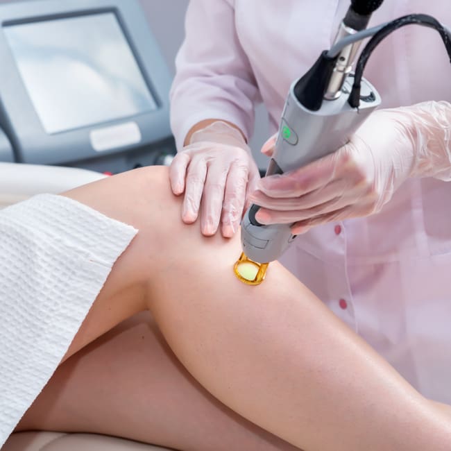 Laser Hair Removal for Face and Body