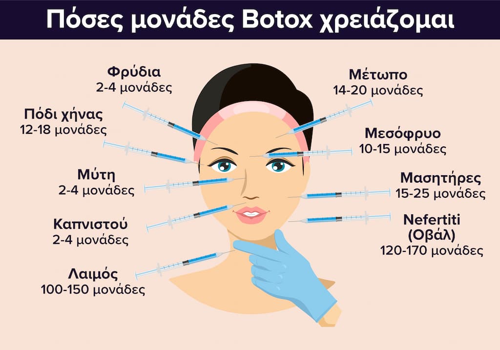 Οι μονάδες ανά δόση Botox στο πρόσωπο επηρεάζουν την τιμή.