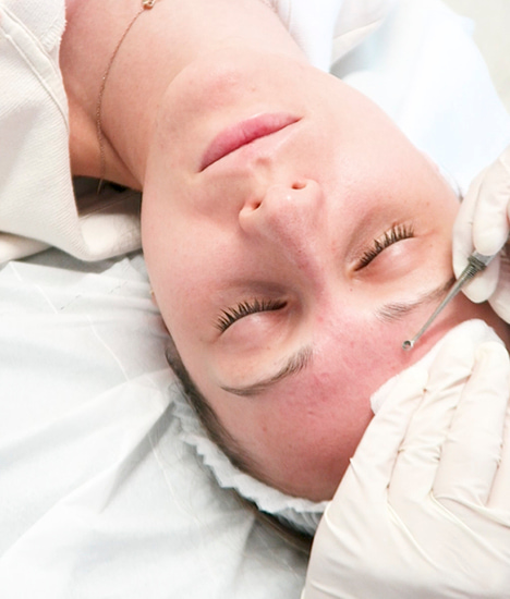 Προσφορά Καθαρισμός Προσώπου με Χημικό Peeling