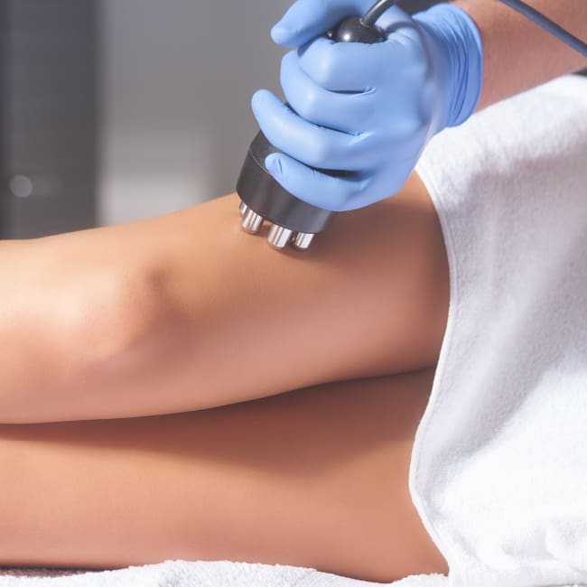 Cavitation RF για Σύσφιξη Επιδερμίδας