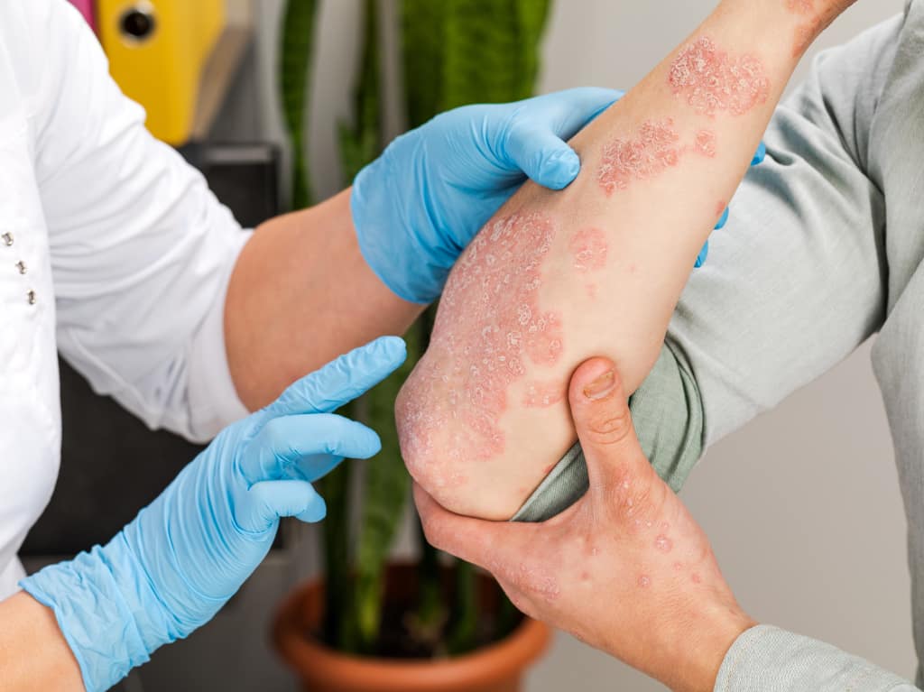 Treatments of skin diseases.