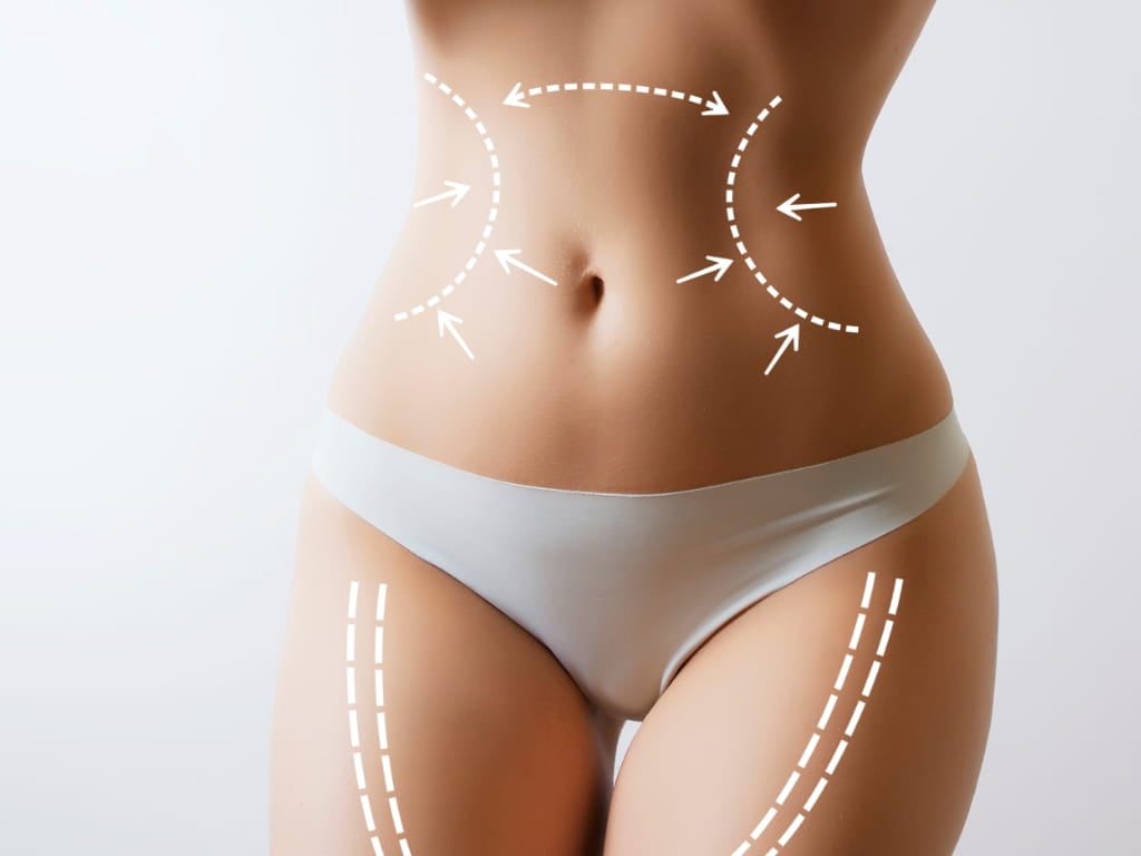 Liposuction - Liposculpture.